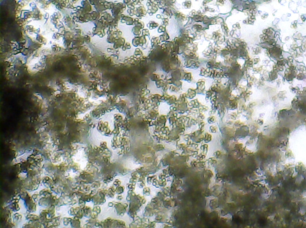 Clumps of spherical Trichoderma spores